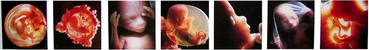 Эмбрион на третьем месяце от зачатия