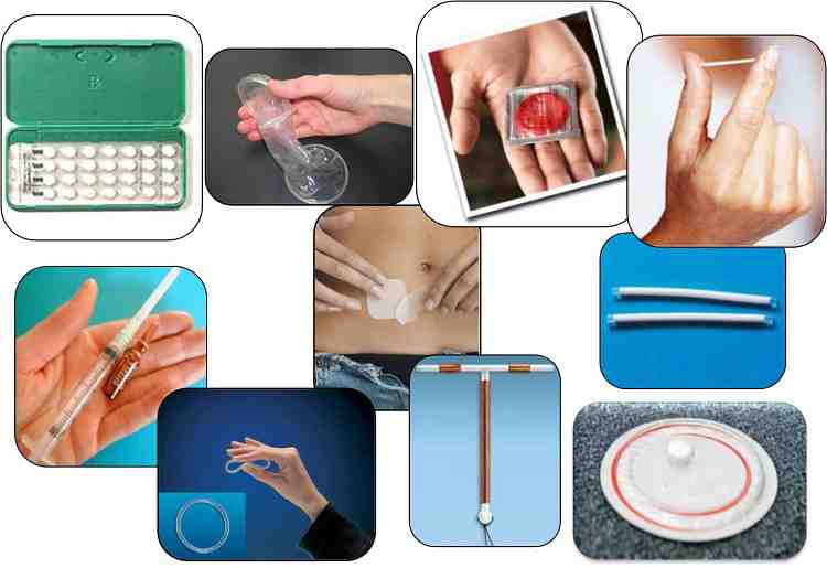 Методы современной контрацепции