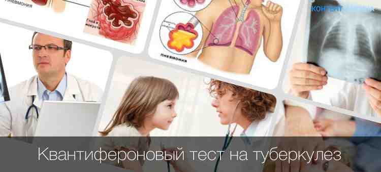 Методы диагностики туберкулеза